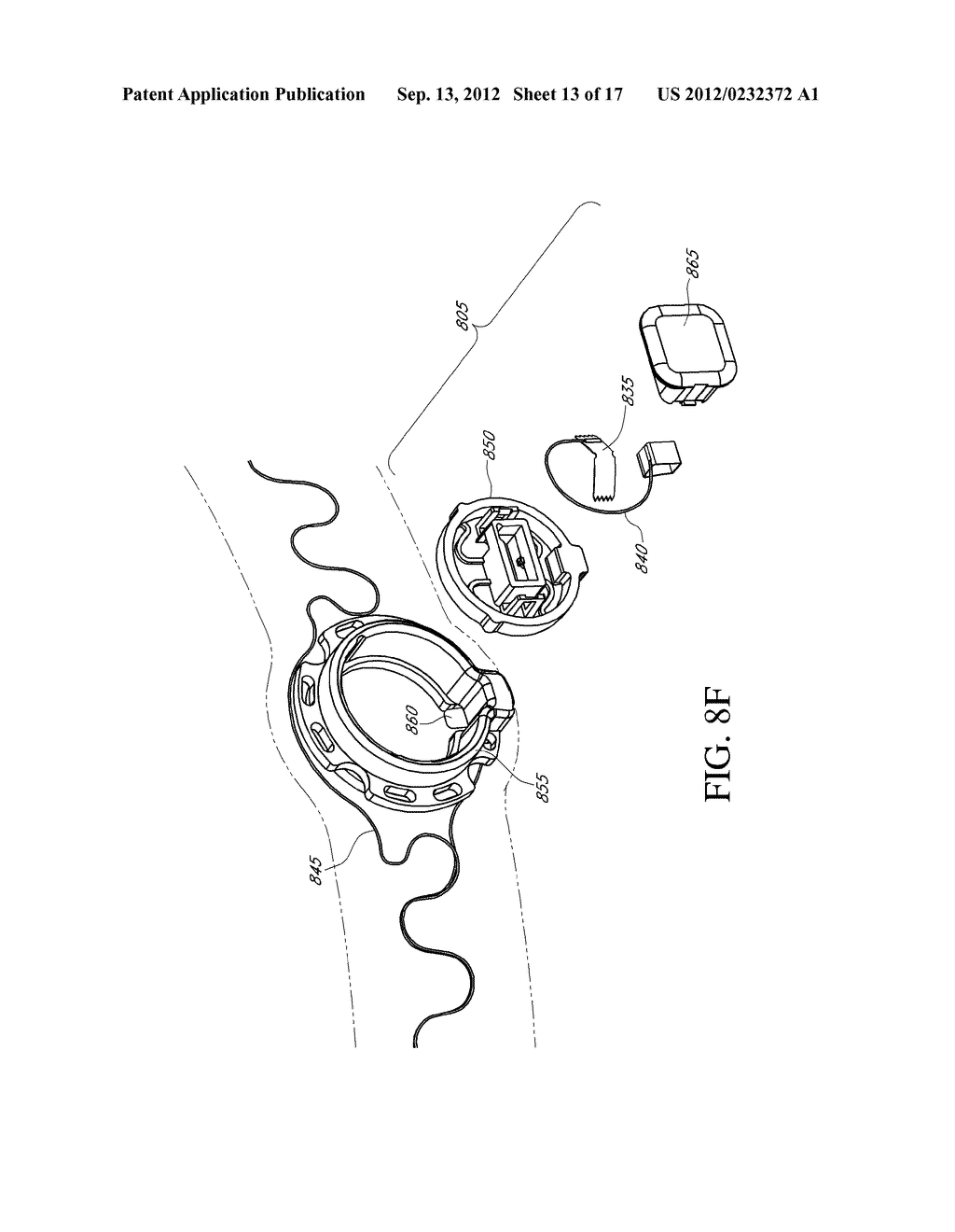 METHOD AND DEVICE FOR QUICK PRESS ON EEG ELECTRODE - diagram, schematic, and image 14