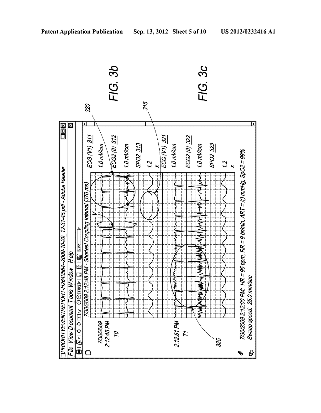 METHODS & SYSTEMS TO DETERMINE MULTI-PARAMETER MANAGED ALARM HIERARCHY     DURING PATIENT MONITORING - diagram, schematic, and image 06