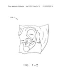 RESPONSE TESTING FOR CONSCIOUS SEDATION UTILIZING A     NON-EAR-CANAL-CONTACTING SPEAKER diagram and image