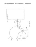 RESPONSE TESTING FOR CONSCIOUS SEDATION UTILIZING A     NON-EAR-CANAL-CONTACTING SPEAKER diagram and image