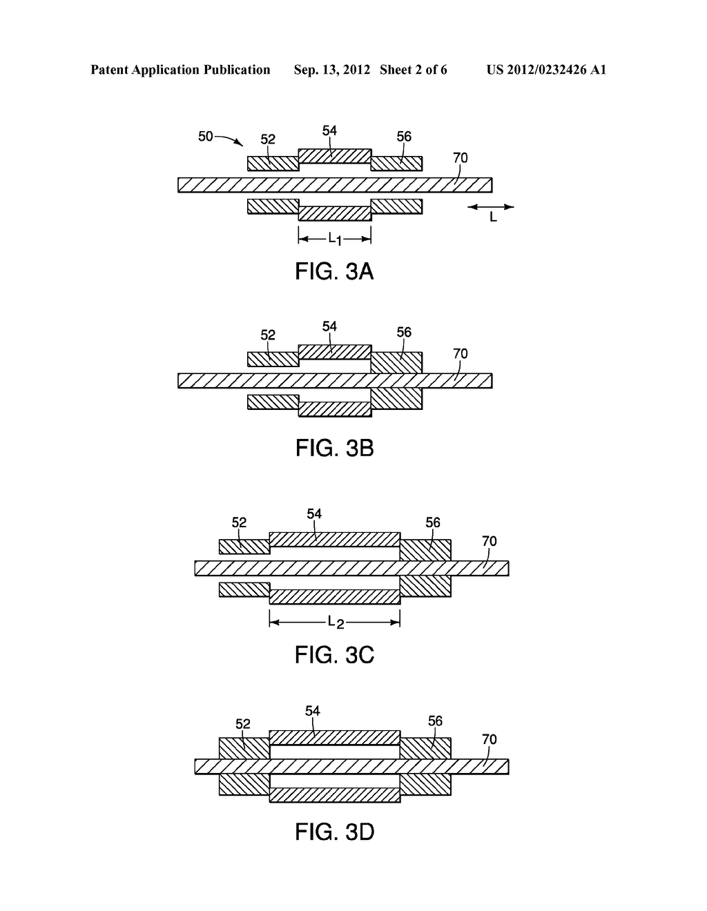 APPARATUS AND METHODS FOR ADVANCING A WIRE GUIDE - diagram, schematic, and image 03