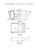 SYSTEMS AND METHODS FOR DEEP VEIN THROMBOSIS PROPHYLAXIS diagram and image