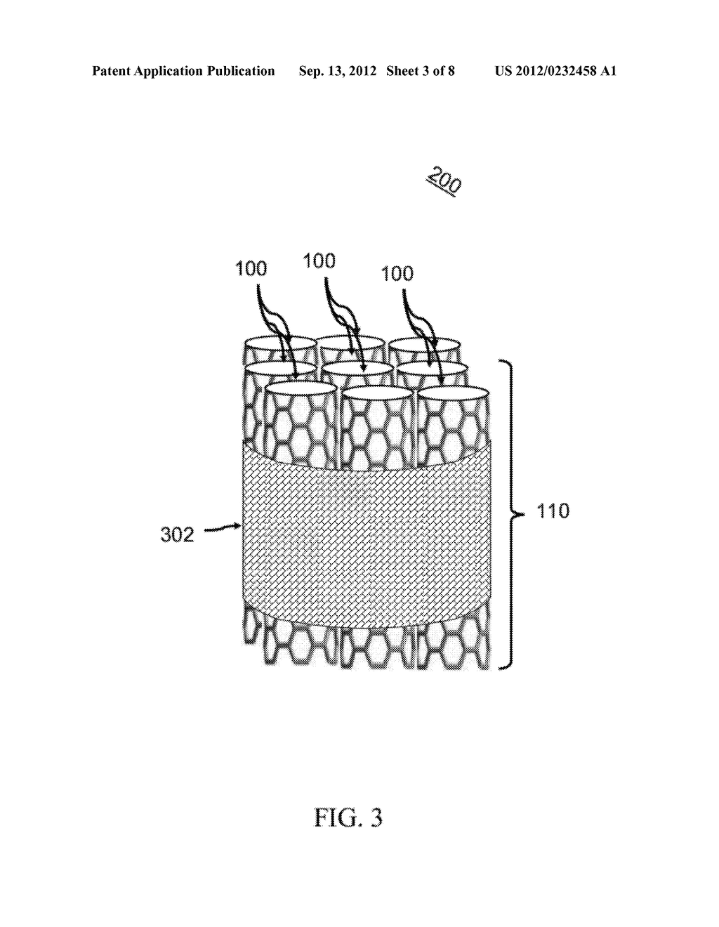 IMPLANTABLE SYSTEMS AND METHODS FOR REMOVING SPECIFIC IMPURITIES FROM     FLUIDS SUCH AS BLOOD - diagram, schematic, and image 04