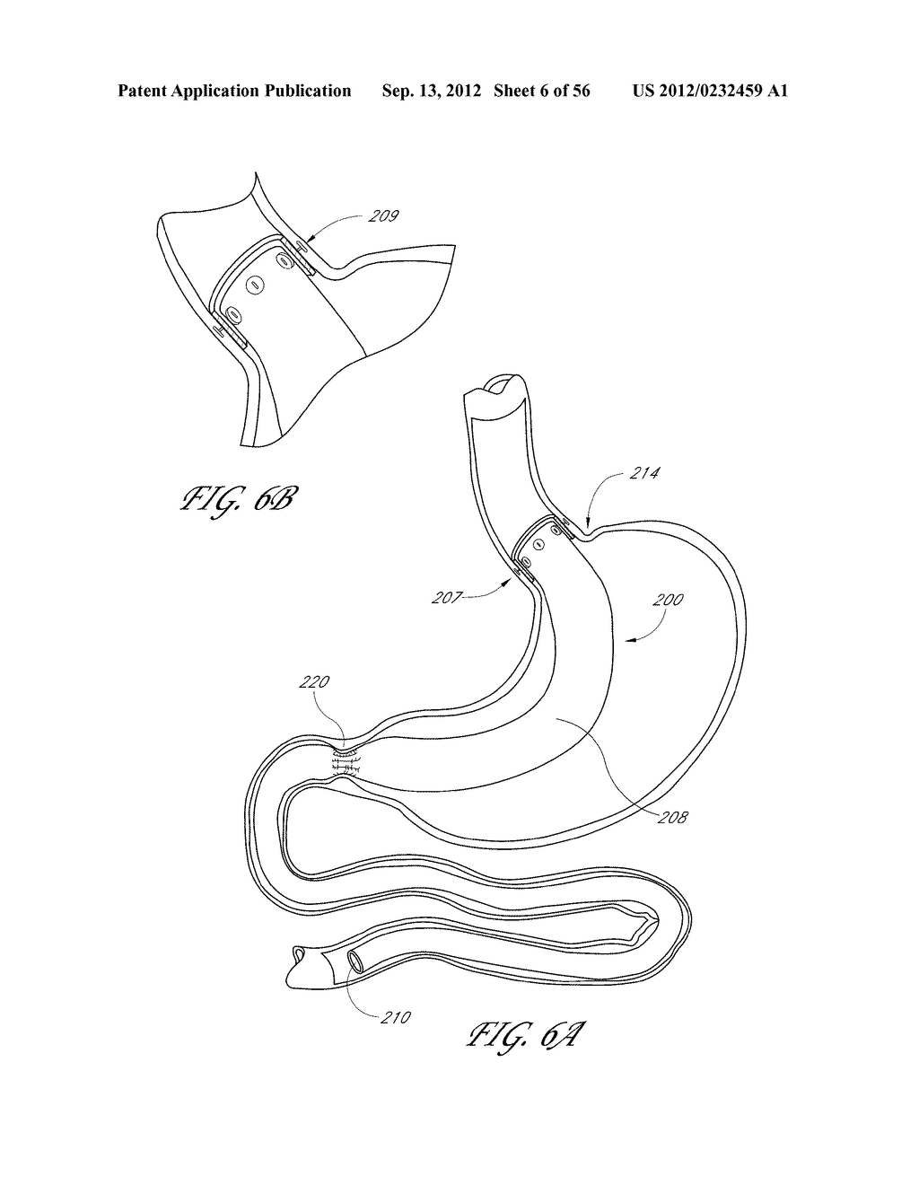 DEVICES AND METHODS FOR ENDOLUMENAL GASTROINTESTINAL BYPASS - diagram, schematic, and image 07