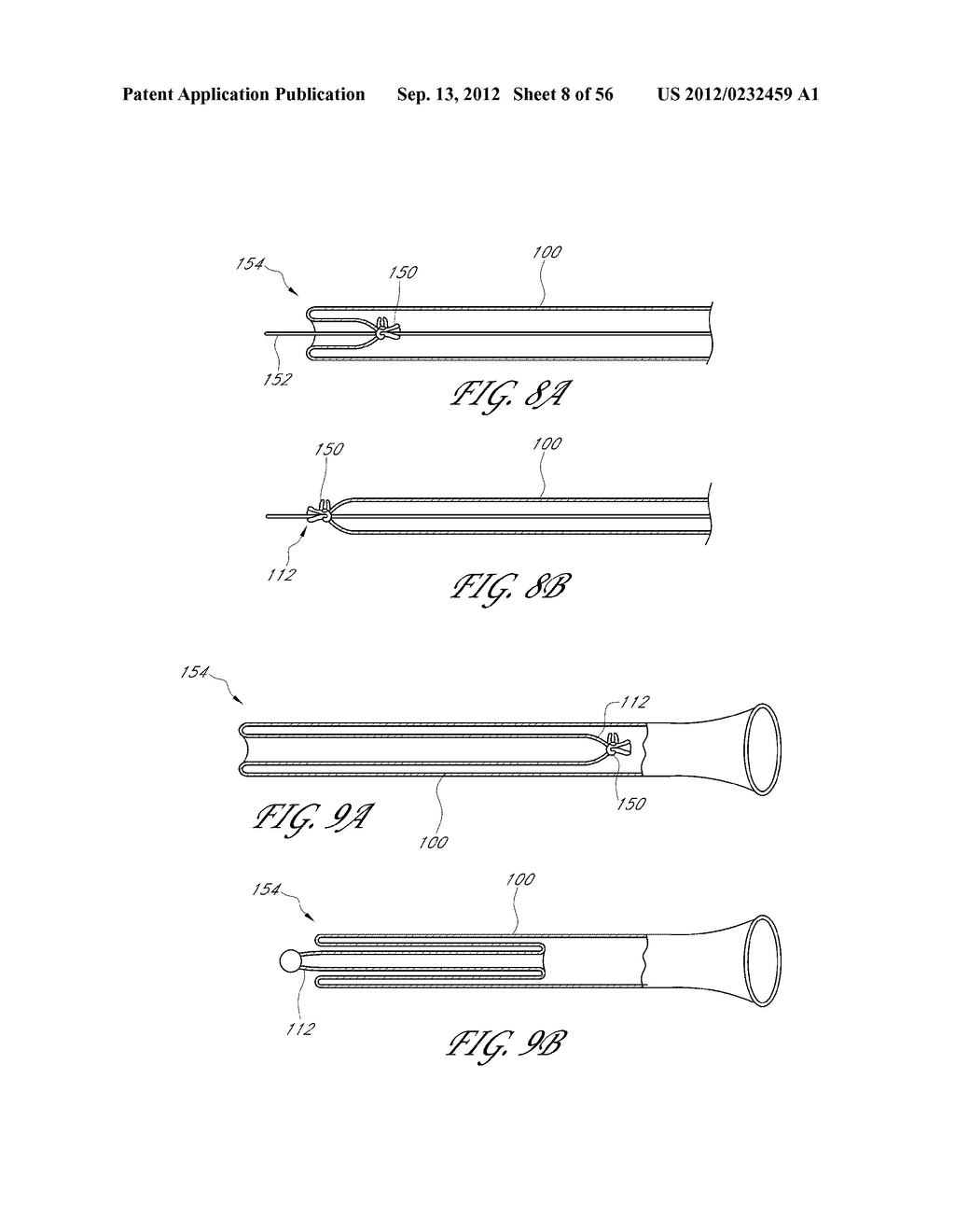 DEVICES AND METHODS FOR ENDOLUMENAL GASTROINTESTINAL BYPASS - diagram, schematic, and image 09