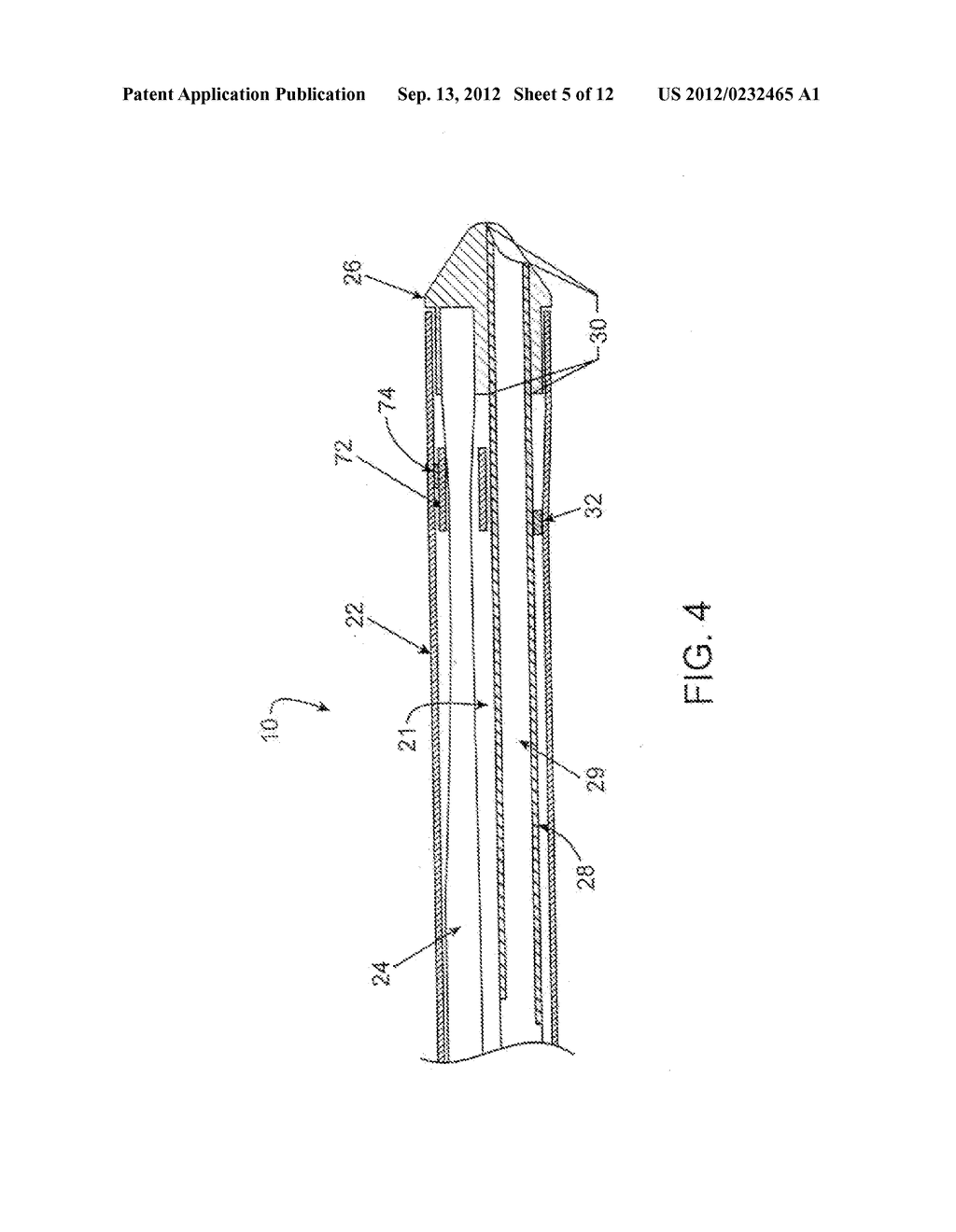 ULTRASOUND CATHETER AND METHODS FOR MAKING AND USING SAME - diagram, schematic, and image 06