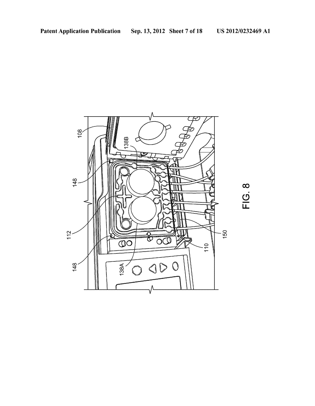 MEDICAL FLUID DELIVERY SETS AND RELATED SYSTEMS AND METHODS - diagram, schematic, and image 08