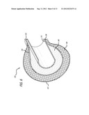 Directional Anchoring Mechanism, Method And Applications Thereof diagram and image