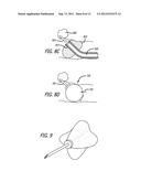 Directional Anchoring Mechanism, Method And Applications Thereof diagram and image