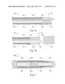 SHORT WIRE CABLE CATHETER diagram and image