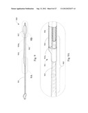 SHORT WIRE CABLE CATHETER diagram and image