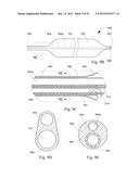 SHORT WIRE CABLE CATHETER diagram and image