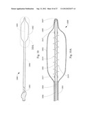 SHORT WIRE CABLE CATHETER diagram and image