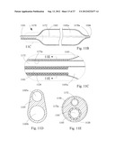 SHORT WIRE CABLE CATHETER diagram and image