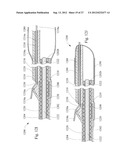 SHORT WIRE CABLE CATHETER diagram and image