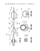 SHORT WIRE CABLE CATHETER diagram and image