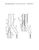 SHORT WIRE CABLE CATHETER diagram and image