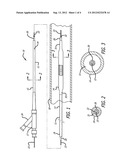 CATHETER WITH RADIOPAQUE COIL diagram and image