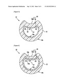 CATHETER WITH VALVE diagram and image