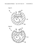 CATHETER WITH VALVE diagram and image