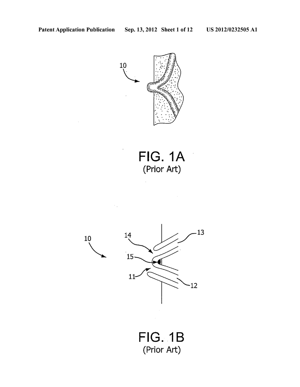 Medical Device for use with a Stoma - diagram, schematic, and image 02