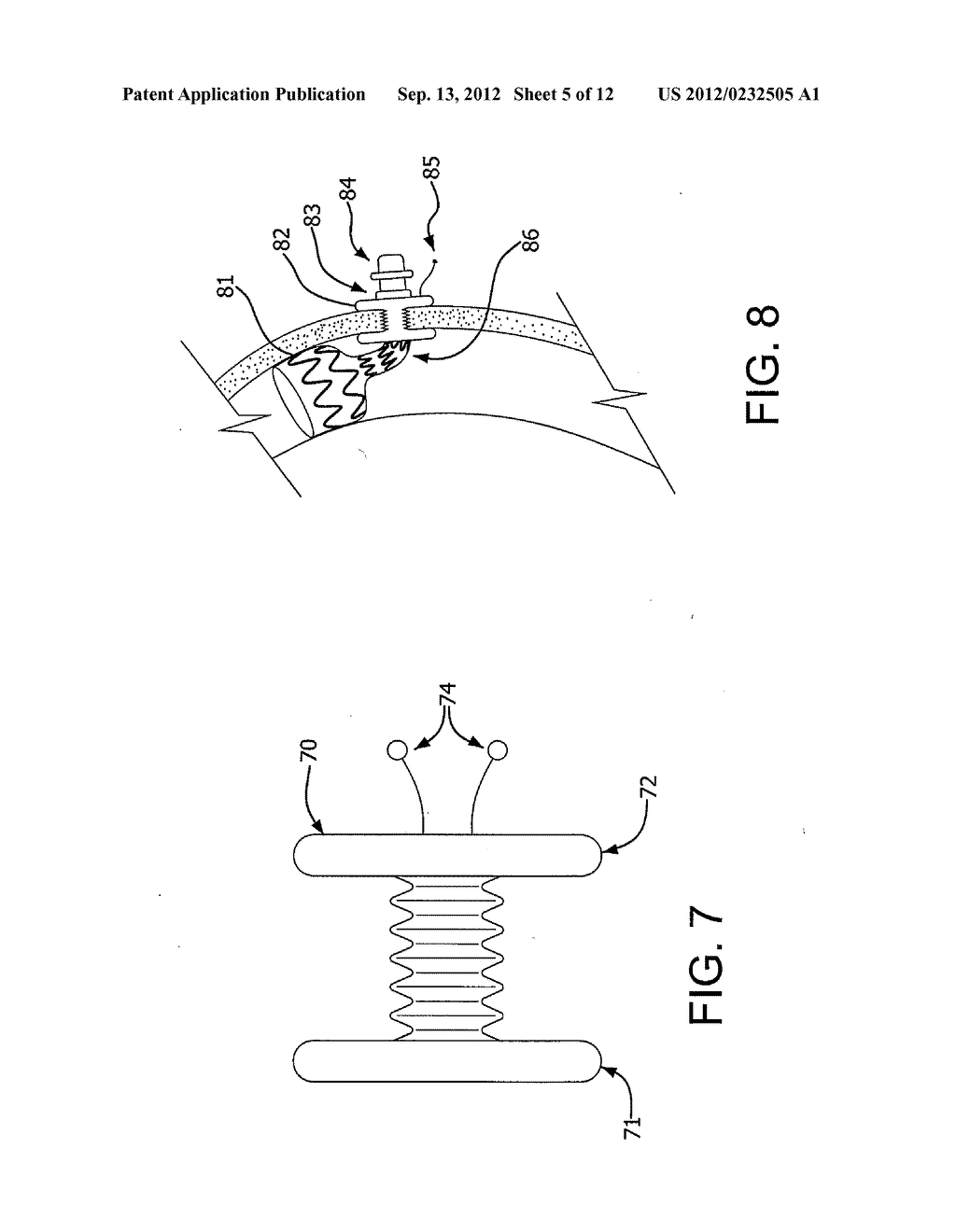 Medical Device for use with a Stoma - diagram, schematic, and image 06