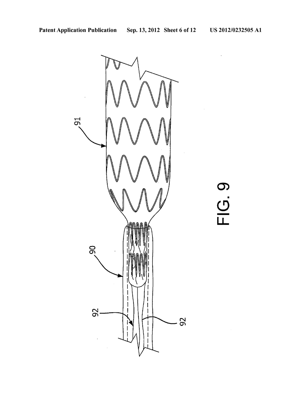 Medical Device for use with a Stoma - diagram, schematic, and image 07