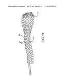 Medical Device for use with a Stoma diagram and image