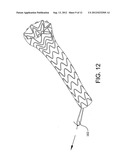 Medical Device for use with a Stoma diagram and image