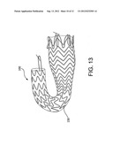 Medical Device for use with a Stoma diagram and image