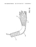 Medical Device for use with a Stoma diagram and image