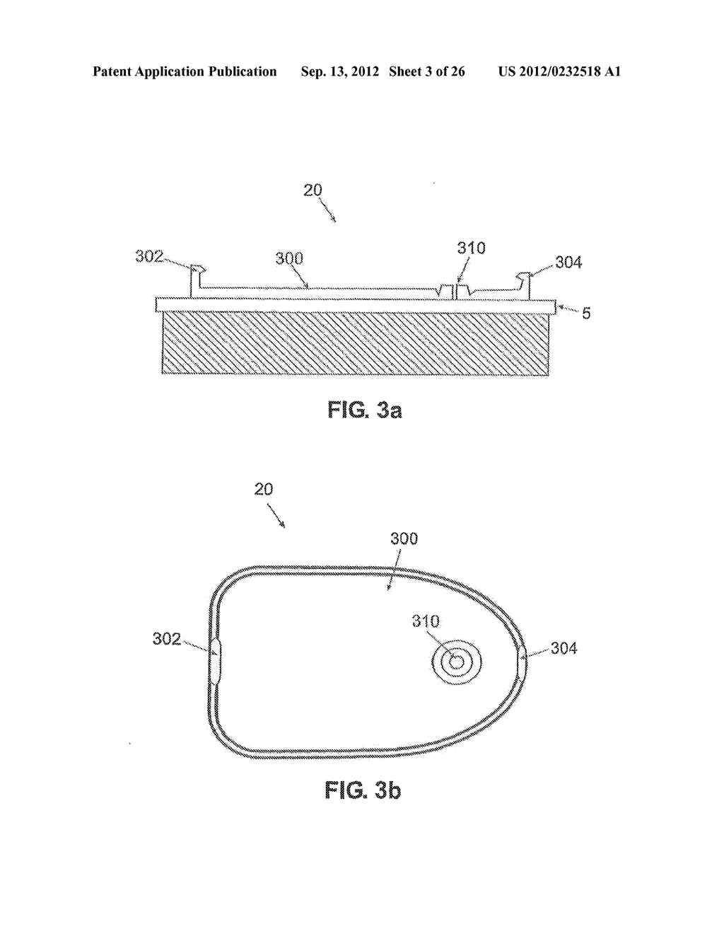 DETACHABLE PORTABLE INFUSION DEVICE - diagram, schematic, and image 04