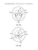 MULTI-WAVELENGTH LASER AND METHOD FOR CONTACT ABLATION OF TISSUE diagram and image