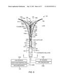 SYSTEM AND METHOD FOR ENDOMETRIAL ABLATION diagram and image