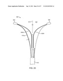 SYSTEM AND METHOD FOR ENDOMETRIAL ABLATION diagram and image