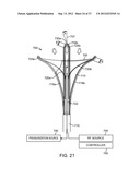 SYSTEM AND METHOD FOR ENDOMETRIAL ABLATION diagram and image