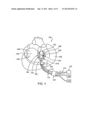 ABLATIVE TREATMENT OF THE HEART TO IMPROVE PATIENT OUTCOMES FOLLOWING     SURGERY diagram and image