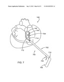 ABLATIVE TREATMENT OF THE HEART TO IMPROVE PATIENT OUTCOMES FOLLOWING     SURGERY diagram and image