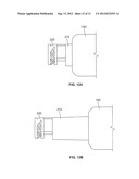 Bronchoscope-Compatible Catheter Provided with Electrosurgical Device diagram and image