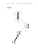 METHOD FOR IMPROVING BLOOD FLOW IN BONE HEAD diagram and image