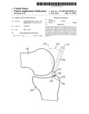 Medical Puncturing Device diagram and image