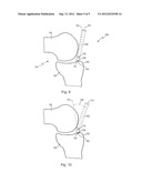 Medical Puncturing Device diagram and image