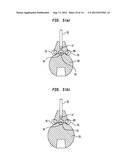 Pneumatic Surgical Instrument and Corresponding Methods for Implanting,     Extracting and Reorienting Orthopedic Implants diagram and image