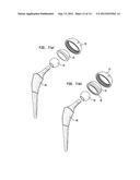 Pneumatic Surgical Instrument and Corresponding Methods for Implanting,     Extracting and Reorienting Orthopedic Implants diagram and image