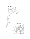 Pneumatic Surgical Instrument and Corresponding Methods for Implanting,     Extracting and Reorienting Orthopedic Implants diagram and image