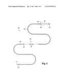 SURGICAL TREATMENT OF GASTRIC EMPTYING DISORDERS diagram and image