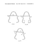 Wound Closing Device diagram and image