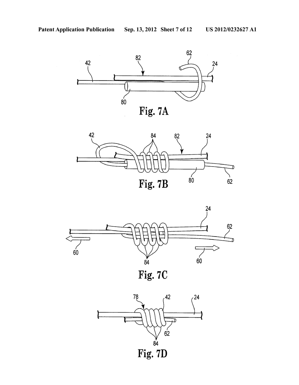 PRE-SUTURED ANCHOR FOR IMPLANTABLE LEADS - diagram, schematic, and image 08