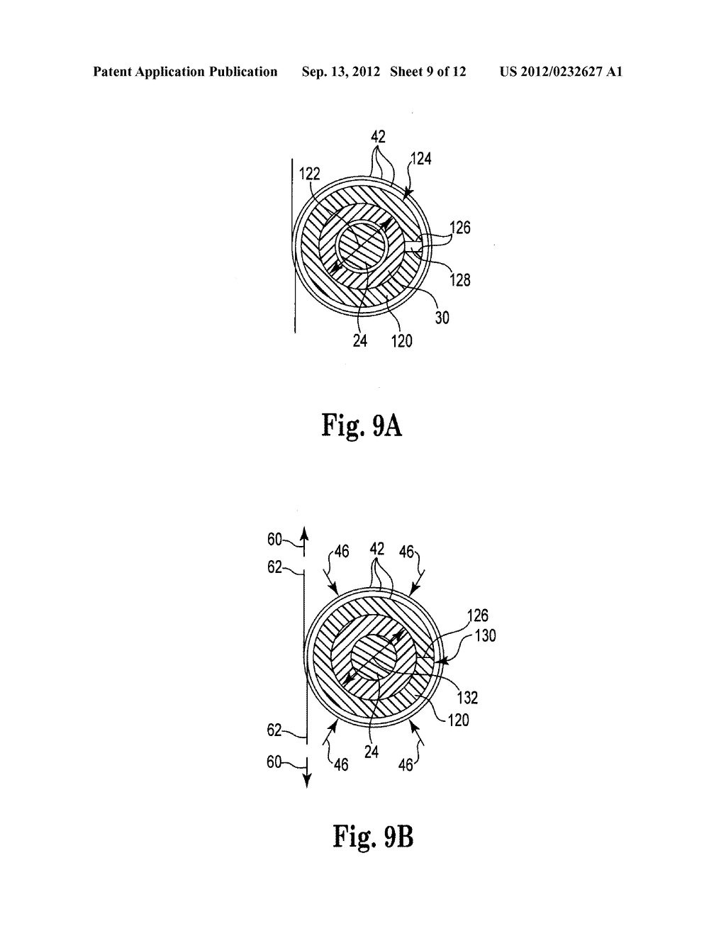 PRE-SUTURED ANCHOR FOR IMPLANTABLE LEADS - diagram, schematic, and image 10