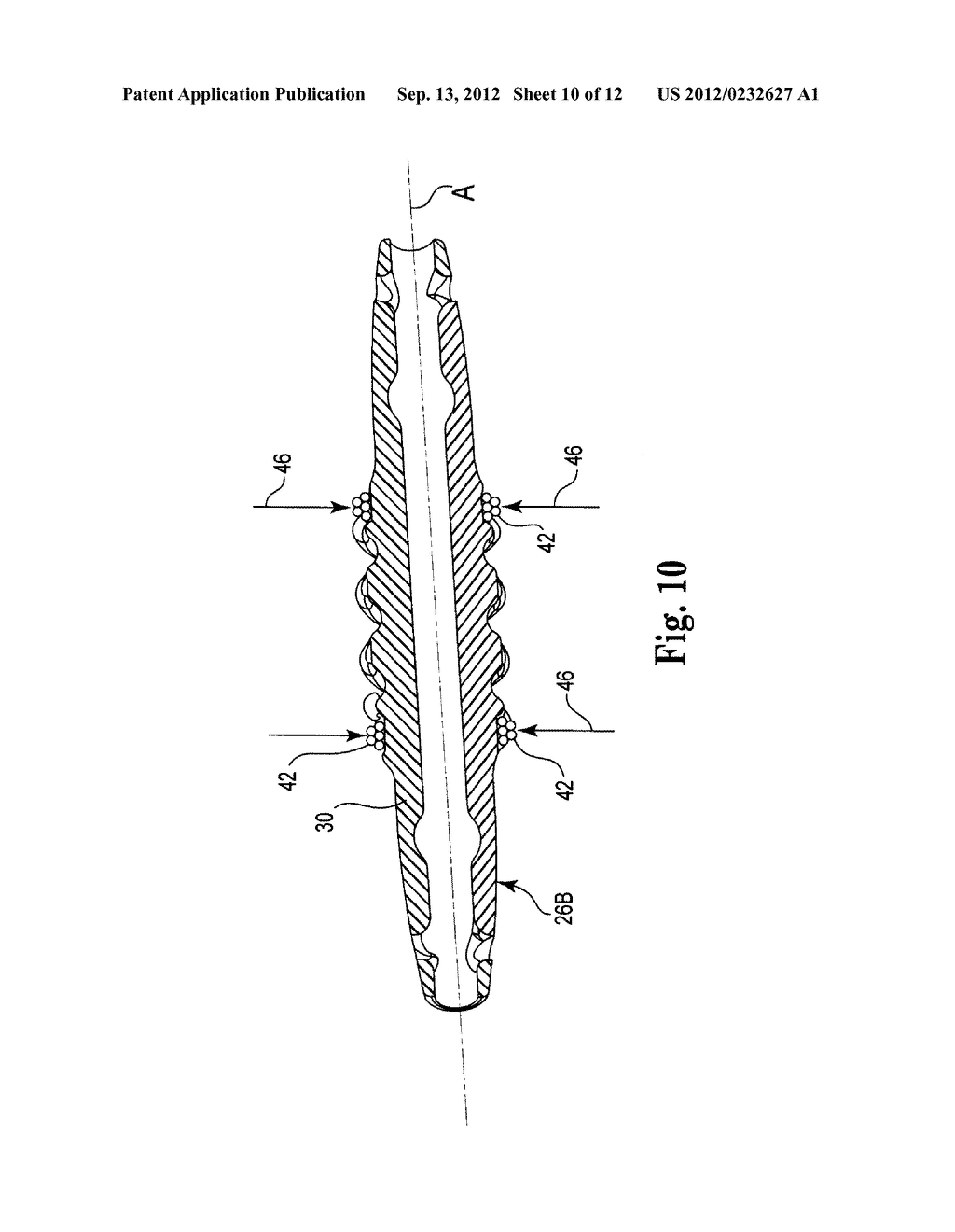 PRE-SUTURED ANCHOR FOR IMPLANTABLE LEADS - diagram, schematic, and image 11